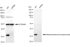 Western blotting analysis using Methylthioadenosine phosphorylase antibody (ABIN7799397).