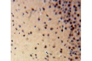 Used in DAB staining on fromalin fixed paraffin-embedded Brain tissue (LIG1 抗体  (AA 568-875))