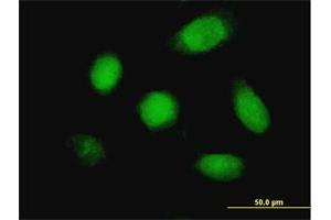 Immunofluorescence of monoclonal antibody to DUSP5 on HeLa cell.