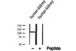 Western blot analysis of extracts from human kidney, using MKS3 antibody. (TMEM67 抗体  (Internal Region))