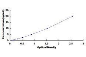 ELISA image for Histone Deacetylase 5 (HDAC5) ELISA Kit (ABIN3167731) (HDAC5 ELISA 试剂盒)