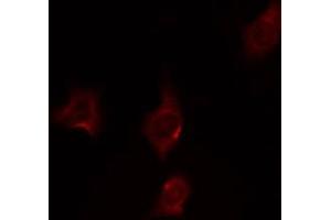 ABIN6274870 staining HepG2 by IF/ICC. (Ataxin 2 抗体  (Internal Region))