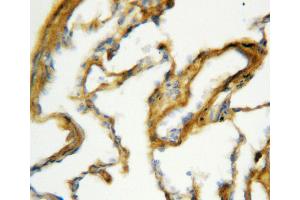 Anti-Surfactant Protein A antibody, IHC(P) IHC(P): Rat Lung Tissue (Surfactant Protein A1 抗体  (C-Term))