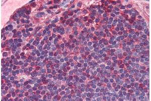 Human Colon, MALT (formalin-fixed, paraffin-embedded) stained with IL7R antibody ABIN351552 at 5 ug/ml followed by biotinylated goat anti-rabbit IgG secondary antibody ABIN481713, alkaline phosphatase-streptavidin and chromogen. (IL7R 抗体  (C-Term))