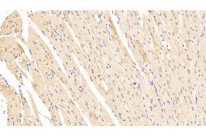 Detection of LAMb2 in Mouse Heart Tissue using Polyclonal Antibody to Laminin Beta 2 (LAMb2) (LAMB2 抗体  (AA 1176-1309))