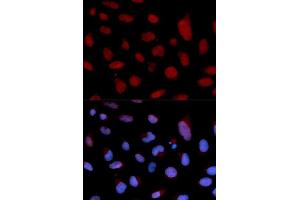 Immunofluorescence analysis of U2OS cells using TNNC1 antibody.