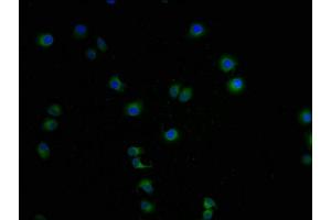 Immunofluorescence staining of A549 cells with ABIN7158014-IF at 1:100, counter-stained with DAPI. (LCMT1 抗体  (AA 157-357))