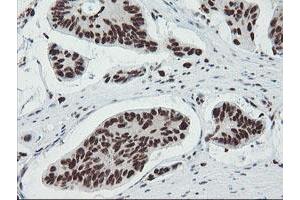 Image no. 9 for anti-TP53RK Binding Protein (TPRKB) antibody (ABIN1501484)