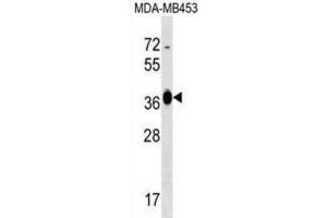 Western Blotting (WB) image for anti-Glucose-Fructose Oxidoreductase Domain Containing 2 (GFOD2) antibody (ABIN2999227) (GFOD2 抗体)
