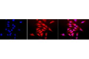 Immunocytochemistry/Immunofluorescence analysis using Rabbit Anti-SOD (Cu/Zn) Polyclonal Antibody (ABIN361651 and ABIN361652). (SOD1 抗体)
