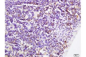 Formalin-fixed and paraffin embedded mouse spleen labeled with Rabbit Anti p53AIP1 Polyclonal Antibody, Unconjugated (ABIN872405) at 1:200 followed by conjugation to the secondary antibody and DAB staining (TP53AIP1 抗体  (AA 65-124))