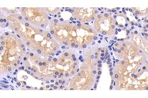 Detection of CASP8 in Human Kidney Tissue using Polyclonal Antibody to Caspase 8 (CASP8) (Caspase 8 抗体  (AA 217-384))