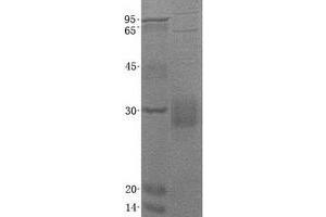 Western Blotting (WB) image for CD8b Molecule (CD8B) (Transcript Variant 6) protein (His tag) (ABIN2713780)