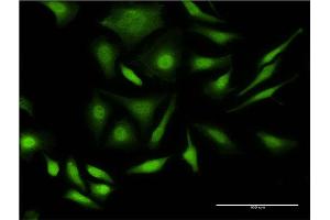 Immunofluorescence of monoclonal antibody to PRPF4B on HeLa cell. (PRPF4B 抗体  (AA 898-1005))