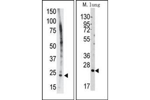 Image no. 1 for anti-BH3 Interacting Domain Death Agonist (BID) (BH3 Domain) antibody (ABIN356816)