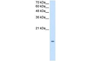 MGST2 antibody used at 1. (MGST2 抗体  (N-Term))