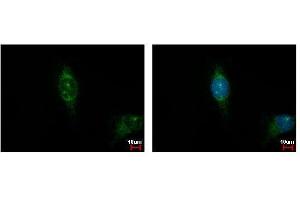 ICC/IF Image Casein Kinase 1 alpha 1L antibody detects CSNK1A1L protein at cytoplasm by immunofluorescent analysis. (CSNK1A1L 抗体)