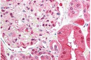 Human Kidney (formalin-fixed, paraffin-embedded) stained with BRCC3 antibody ABIN213911 at 5 ug/ml followed by biotinylated goat anti-rabbit IgG secondary antibody ABIN481713, alkaline phosphatase-streptavidin and chromogen. (BRCC3 抗体  (N-Term))