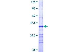 CYP2D6 Protein (AA 91-190) (GST tag)