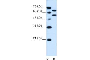 Western Blotting (WB) image for anti-Nucleotide Exchange Factor SIL1 (SIL1) antibody (ABIN2463991) (SIL1 抗体)