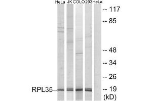 Western blot analysis of extracts from HeLa cells, Jurkat cells, COLO cells and 293 cells, using RPL35 antibody. (RPL35 抗体  (Internal Region))