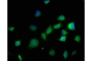 Immunofluorescence staining of SH-SY5Y cells with ABIN7150001 at 1:166, counter-stained with DAPI. (DPH5 抗体  (AA 138-235))