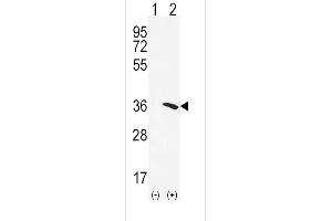Western blot analysis of NAT2 (arrow) using rabbit polyclonal NAT2 Antibody (C-term) (ABIN652275 and ABIN2841158). (NAT2 抗体  (C-Term))