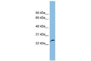GSTK1 antibody used at 1 ug/ml to detect target protein. (GSTK1 抗体  (Middle Region))