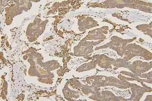 IHC analysis of SFRP1 using anti-SFRP1 antibody (ABIN6719484).