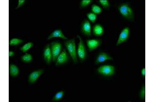 Immunofluorescence staining of A549 cells with ABIN7146392 at 1:133, counter-stained with DAPI. (PNPLA8 抗体  (AA 158-345))