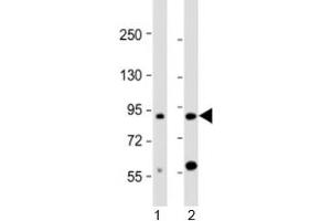 Western blot testing of human 1) brain and 2) HL-60 cell lysate with CCDC144A antibody at 1:2000. (CCDC144A 抗体  (AA 1257-1289))