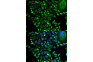 Immunofluorescence (IF) image for anti-Proteasome (Prosome, Macropain) 26S Subunit, Non-ATPase, 10 (PSMD10) antibody (ABIN1874388) (PSMD10 抗体)
