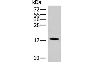 Western blot analysis of Human spleen tissue lysate using NHP2 Polyclonal Antibody at dilution of 1:400 (NHP2 抗体)