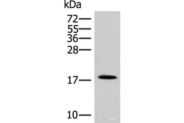 NHP2 antibody