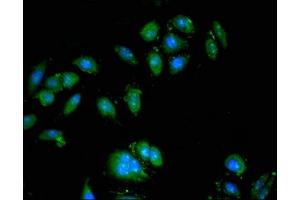 Immunofluorescent analysis of A549 cells using ABIN7175212 at dilution of 1:100 and Alexa Fluor 488-congugated AffiniPure Goat Anti-Rabbit IgG(H+L) (ATP6VA1 (AA 80-260), (Isoform 1) 抗体)
