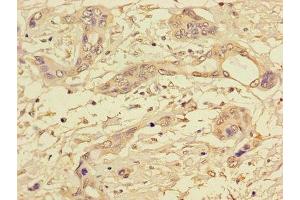 Immunohistochemistry (IHC) image for anti-Protein Phosphatase 1, Catalytic Subunit, gamma Isoform (PPP1CC) (AA 151-323), (Catalytic Subunit) antibody (ABIN7169312)