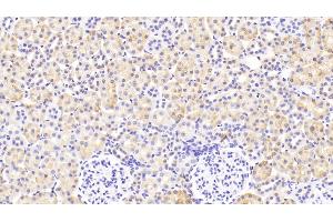 Detection of LZM in Rat Kidney Tissue using Polyclonal Antibody to Lysozyme (LZM) (LYZ 抗体  (AA 19-148))