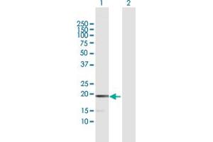 Western Blot analysis of MCEE expression in transfected 293T cell line by MCEE MaxPab polyclonal antibody. (MCEE 抗体  (AA 1-176))