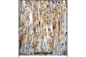 Immunohistochemistry (Paraffin-embedded Sections) (IHC (p)) image for anti-Solute Carrier Family 12 (Potassium-Chloride Transporter) Member 7 (SLC12A7) (AA 89-117), (N-Term) antibody (ABIN656326)