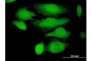 Immunofluorescence of purified MaxPab antibody to TRIM21 on HeLa cell. (TRIM21 抗体  (AA 1-475))