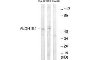 Western blot analysis of extracts from HepG2/COS cells, using ALDH1B1 Antibody. (ALDH1B1 抗体  (AA 311-360))