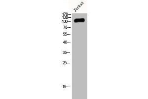 Western Blot analysis of Jurkat cells using JIK Polyclonal Antibody (TAO Kinase 3 抗体  (Internal Region))