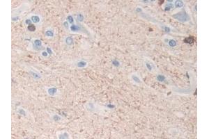 Detection of TPPP in Human Cerebrum Tissue using Polyclonal Antibody to Tubulin Polymerization Promoting Protein (TPPP) (Tppp 抗体  (AA 8-210))