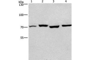 Western Blot analysis of Human fetal liver and Mouse stomach tissue, hela and hepG2 cell using ARNTL Polyclonal Antibody at dilution of 1:450 (ARNTL 抗体)