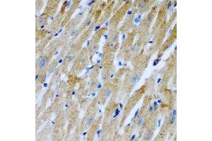 Immunohistochemical analysis of RCN2 staining in rat heart formalin fixed paraffin embedded tissue section. (RCN2 抗体)