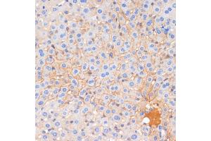 Immunohistochemistry of paraffin-embedded mouse liver using E-Cadherin antibody  at dilution of 1:100 (40x lens). (E-cadherin 抗体)