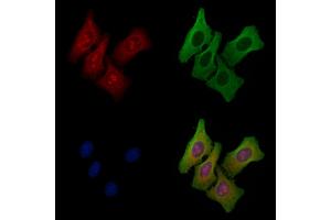 ABIN6258293 and ABIN6275329 staining Hela cells by IF/ICC.