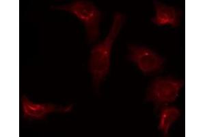 Immunofluorescence (fixed cells) (IF/ICC) image for anti-Solute Carrier Family 39 (Zinc Transporter), Member 7 (SLC39A7) (Internal Region) antibody (ABIN6258402)