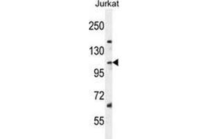Western blot analysis in Jurkat cell line lysates (35ug/lane) using Sorting nexin-25 (SNX25)  Antibody . (SNX25 抗体  (Middle Region))