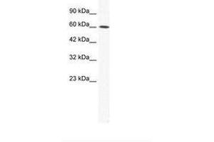 Image no. 1 for anti-Iroquois Homeobox Protein 1 (IRX1) (AA 123-172) antibody (ABIN202627) (IRX1 抗体  (AA 123-172))